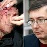МВД Украины: доказательств избиения Луценко силовиками нет