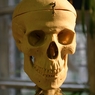 Специалисты из Новосибирска изготавливают индивидуальные 3D-заплатки для черепа