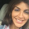 Страдающая аутоиммунным некрозом Алиса Казьмина ужаснула соцсети снимком с открытым лицом