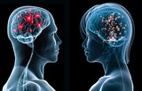 Ученые не нашли различий между мужским и женским мозгом