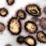 Исследователи выяснили, на каком этапе коронавирус максимально опасен