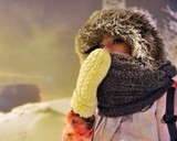 Москва обновила 5-летний рекорд по числу пострадавших от обморожения