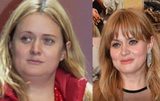 «Никакого ЗОЖ!»: Как похудела на 15 кг Анна Михалкова