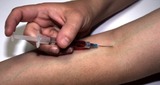 ВОЗ назвала срок начала испытаний вакцины от вируса Зика на людях