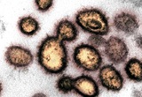 Исследователи выяснили, на каком этапе коронавирус максимально опасен