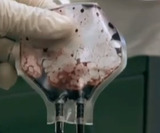 МВД: Кусок железной кровли упал на ребенка в Ленобласти
