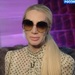 Телеведущая показала синяки на лице, которые получила якобы от Александра Серова