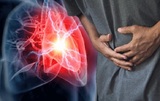 Медики перечислили пять симптомов инфаркта, появляющихся за месяц до приступа