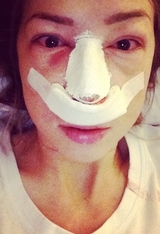 Экс-участница "Дома-2" отрезала свой длинный нос, ФОТО до и после