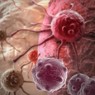 Ученые: В 66% случаев онкозаболевания не обусловлены образом жизни