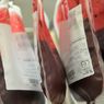 Ученые изобрели новый способ производить искусственную кровь в любых объемах