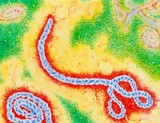 Подозрение на Эболу у россиянина в Алма-Ате не подтвердилось