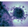 Почти 150 человек заразились коронавирусом в Южной Корее
