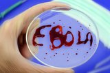 В марте в аптеках появится экспресс-тест для выявления вируса Эбола