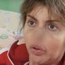 "Слезы душат": Алиса Аршавина  рассказала, как ей далеко до выздоровления и возвращения красоты