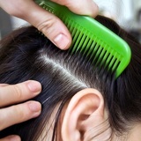 Ученые представили новый метод диагностики болезней – химанализ волос