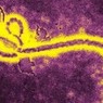 Лихорадка Эбола может перекинуться на Египет