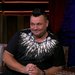 Сергей Жуков впервые рассказал о причине нескольких хирургических операций