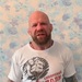 Джеффа Монсона прооперировали в Челябинской области
