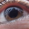 Опасность глаукомы: специалисты назвали основные риски и симптомы болезни