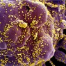 Биологи назвали новую версию появления коронавируса
