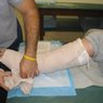 В поликлинике женщина после операции на ноге ползком добиралась на рентген ВИДЕО