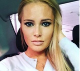 Дана Борисова сделала пластическую операцию - подтяжку лица