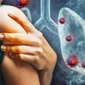 Медики назвали «странный» первый признак рака легких
