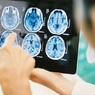 Медики нашли лучшее вещество для здоровья мозга