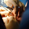 Израильские врачи вернули зрение слепой пациентке, пересадив зуб в её глаз