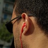Ученые назвали хороший слух признаком болезни