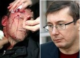 МВД Украины: доказательств избиения Луценко силовиками нет