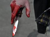Посетитель кафе в центре Москвы получил удар ножом в живот