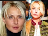 Татьяна Овсиенко стала неузнаваемой от пластики и "уколов красоты"