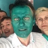 Навальный посмеялся над атакой провокаторов и сам вымазался зеленкой