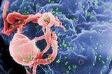 Британские медики заявили о первом случае полного излечения от ВИЧ