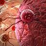 Ученые: Раковые клетки создают собственную кровеносную систему