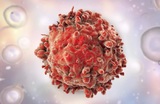Исследователи назвали причины развития некоторых типов рака