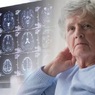 Врачи назвали три ключевых отличия деменции от обычных возрастных проблем с памятью